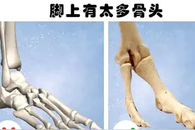 人体天生的缺陷？人类的身体存在的7个给我们带来麻烦的缺陷图片