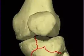 伤残鉴定必须要知道的细节图片