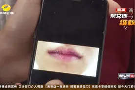 太坑！美容院试用工变“技术院长”，女子术后嘴唇凸起“白线”视频封面
