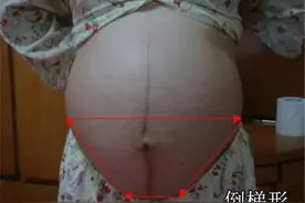 孕肚“倒梯形”生女孩？孕肚“横竖”两条线和形状，都和性别无关图片
