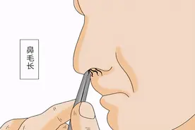 不小心窜出去的鼻毛，用剪刀剪掉会怎样？医生：三个后果要承担图片