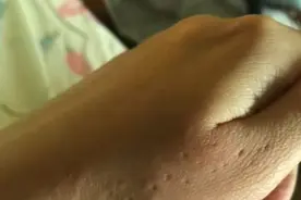 猫咪爱咬人抓人还有救吗？宠物训练师教你如何理解猫咪咬人问题图片