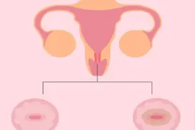 聊一聊女性宫颈那些事（1）宫颈的江湖地位图片