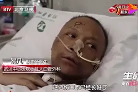 武汉两医生被ECMO救回后脸色发黑，专家解释原因图片