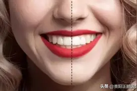 这个社会不仅看脸它还看牙，牙齿需不需要矫正要明白这几点图片