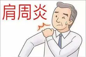 肩周炎疼痛难忍怎么办？市中医院专家推荐一汤方和简单实用的动作助你缓解不适！图片