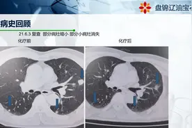 肿瘤类器官药敏试验-晚期肿瘤新的治疗选择图片