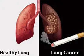 既然香烟会引起肺癌，为何不禁止生产？背后的4个原因不容忽视图片