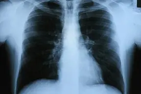 怎么知道你的肺健康不健康？教你8个自测办法，快来试一下图片