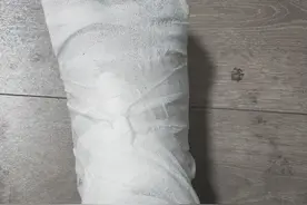 骨折第三天图片