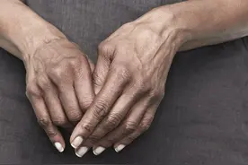 更年期手指僵硬疼痛，挺挺就过去了？医生辟谣，教您如何早期应对图片
