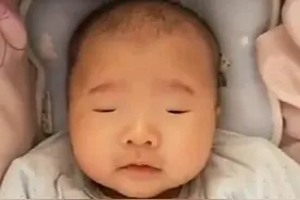 宝宝出生后“没眼睛”，父母急忙送医，医生笑到根本停不下来图片