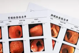 肠道长了息肉，多久会变成癌症？提醒：5种息肉拖太久，不是好事图片