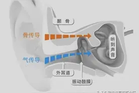 哪种耳机最伤听力？头戴、入耳、耳塞、骨传导耳机听力伤害盘点图片