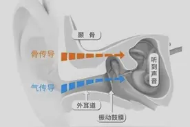 哪种耳机最伤听力？头戴、入耳、耳塞、骨传导耳机听力伤害盘点图片