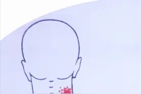 肩膀及肩胛骨内侧缘疼痛，是怎么回事？要如何治疗？请看此文图片