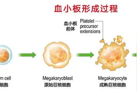 被发现100多年的血小板，竟是这些病的“帮凶”！难怪要体检检测图片