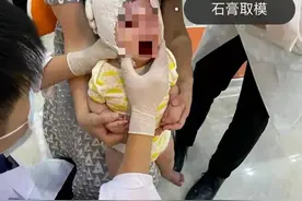 好不容易消灭了裹脚，这群人又开始给婴儿裹头了图片