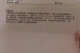 乳腺结节B超4B，钼靶4A，最终翻盘良性的心路历程图片