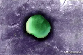 淋病有着极强的传染性，女性感染了会怎么样？不要认为会不治而愈图片