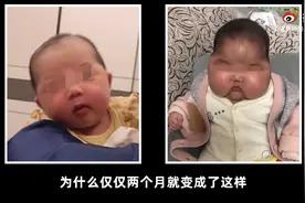 5月大婴儿用抑菌霜成“大头娃娃”，发育迟缓额头长毛！这些宝宝霜，不要再用了图片