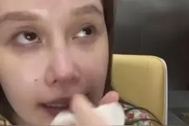 赵本山女儿24岁近照：病态整容，骨瘦如柴，网友：越来越像郑爽图片