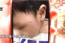 孩子脸上有血痕，家长在幼儿园监控里发现不少情况......图片