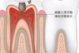 牙疼含口冰水就能好？图片