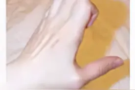 类风湿性关节炎的运动康复锻炼方法图片