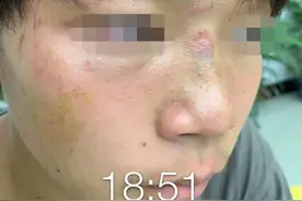 14岁男生遭9名同学围殴致脑震荡！有的竟是为了凑热闹图片