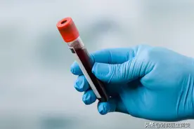 男子慢性肾衰，中医用一味中药降肌酐，大黄为何能稳定肾功能？图片