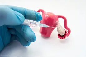 卵巢囊肿和性生活有关系吗？患上了该怎么办？一一给你讲解图片