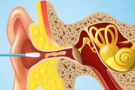沉迷采耳，教训惨痛图片
