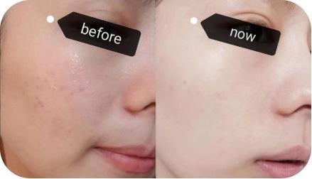 皮肤科医生提醒：原来我的“洗脸”方式一直是错的…细思极恐