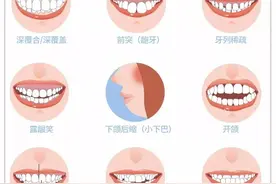 完美笑线，关于笑容的秘密图片