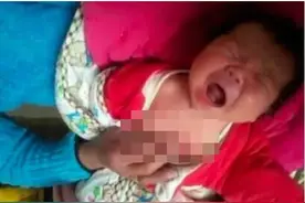 因为奶奶这个动作，女宝恐一生没乳房！妈妈崩溃：孩子一生都毁了图片
