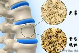 夜晚睡觉经常抽筋是缺钙吗？医生：老年人频繁抽筋，留心2种病图片