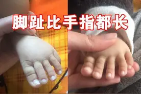 宝宝的脚趾比手指长，网友：夏天基本告别凉鞋，妈妈如何理性面对图片