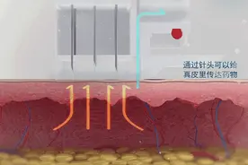 第一次做"机打水光针"？给您一些有用的建议图片