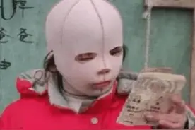 河南女孩曹斐：因戴面具生活被同学嘲笑，取下面具后却让众人羞愧图片