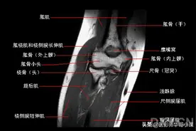 肘关节磁共振（MRI）解剖--精品图集图片