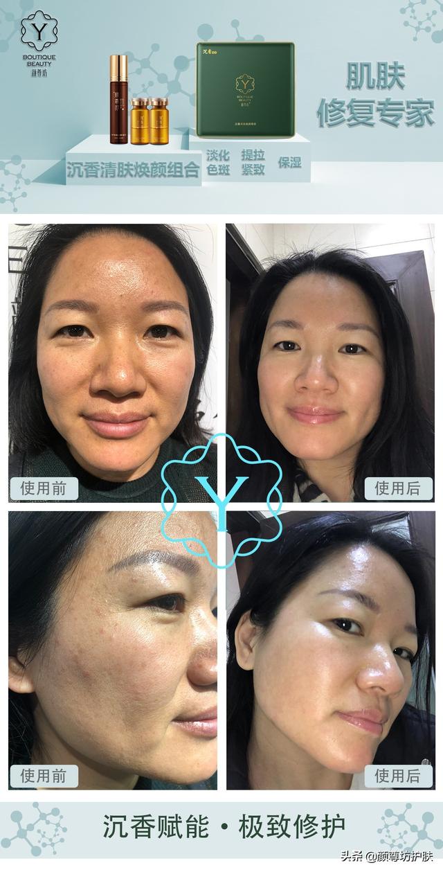 脸部出现了这些症状，说明你需要给脸部排个毒了