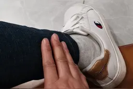 小腿外侧冒热气一例图片