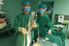门医技术丨不仅仅是微创，这个取石手术难度还有点大！图片