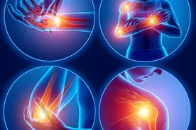 50岁左右的女性，出现各种疼痛，可能是更年期问题，该如何补钙图片