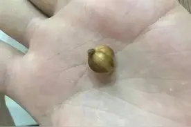 男子吃面竟吃出“怪球”，吓得赶忙报警，警察竟说：何必小题大做图片