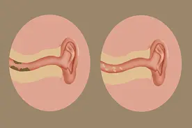 为什么人们说长油耳朵的人，容易有狐臭？别自卑，油耳朵也有优势图片