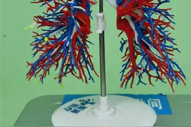 贵州省首例3D打印模型下的精准肺段切除手术在省医完成图片