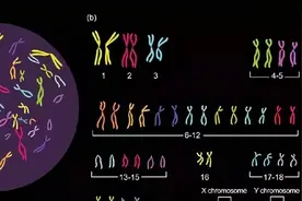 染色体+精子质量三大检查，男性孕前必查利器图片