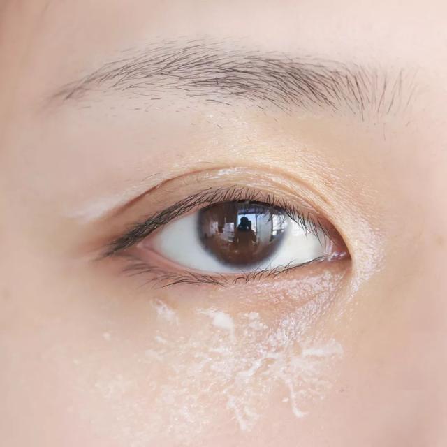 手臂上鸡皮疙瘩变白